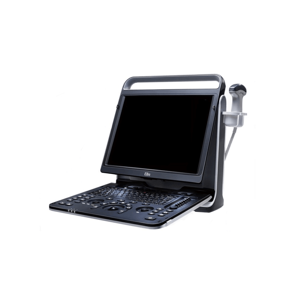 Chison Ebit 60 - Sentinel Imaging Group